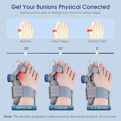 Hyggear Bunion Fix Pro - Corrector for Women And Men : Adjustable Bunion Fix for Big Toe Separation Pain Relief Orthopedic Bunion Splint with Straightener for Toe Alignment and Bunion Fix