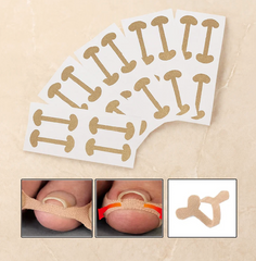 Hyggear Ingrown Toenail Set with Breathable Ingrown Toenail Patches