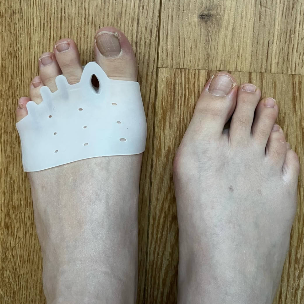 The Benefits of Hyggear Silicone Toe Separators: A Natural Solution for Foot Pain