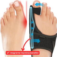 Hyggear Verstellbare Zehenkorrektur-Bandage für Tag und Nacht (mit integriertem Aluminiumstreifen)