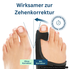 Hyggear Verstellbare Zehenkorrektur-Bandage für Tag und Nacht (mit integriertem Aluminiumstreifen)