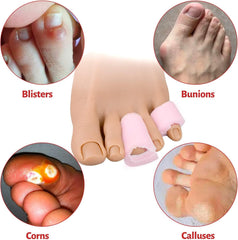 Hyggear™ Hammer Toe Fix - Hammer Toes Sleeve with Overlap Medium Size Roll, Sponge Toe Protectors for Hammer Toes - 22979067572