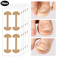 Hyggear Ingrown Toenail Set with Breathable Ingrown Toenail Patches