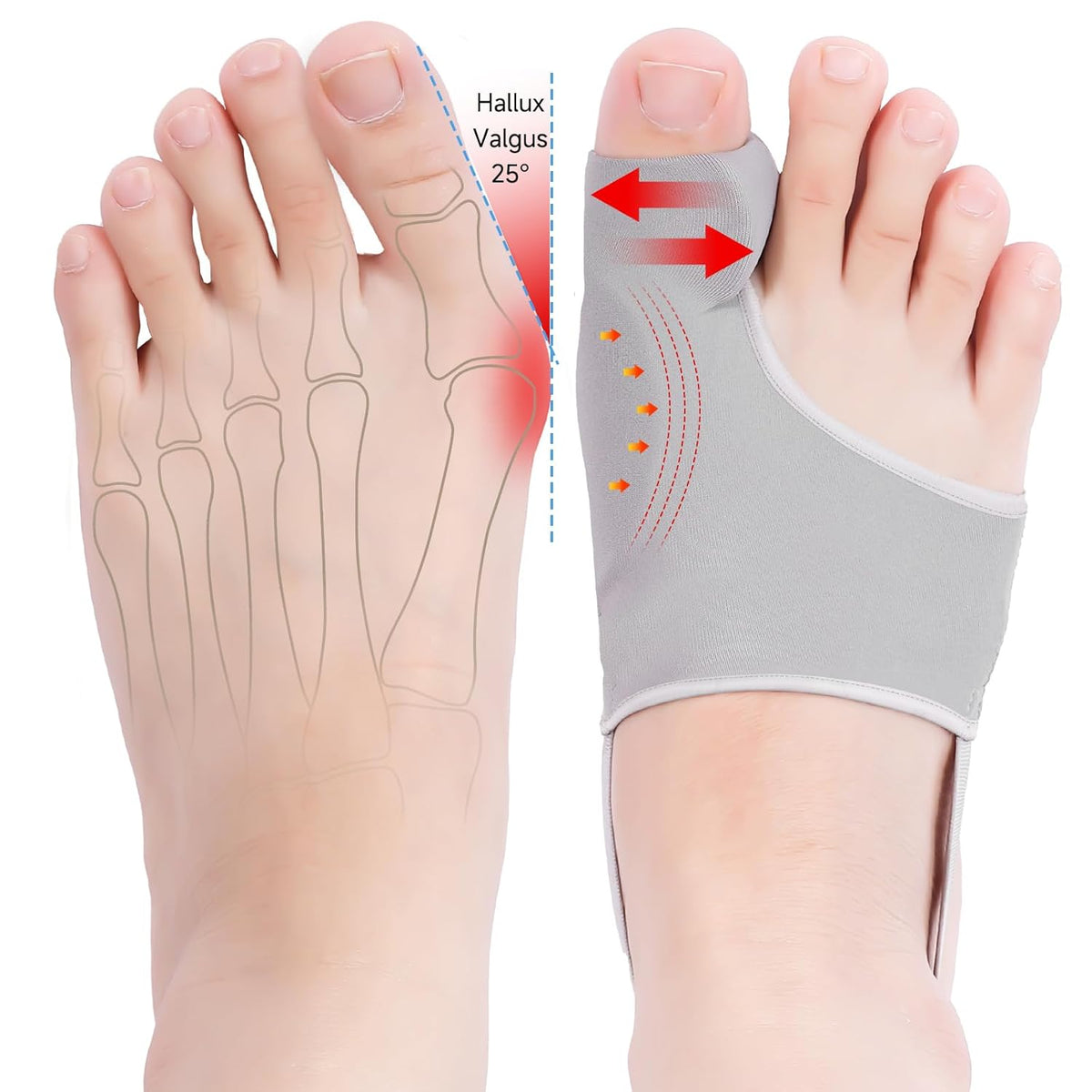 HYGGEAR BIG TOE BUNION HALLUX VALGUS CORRECTOR