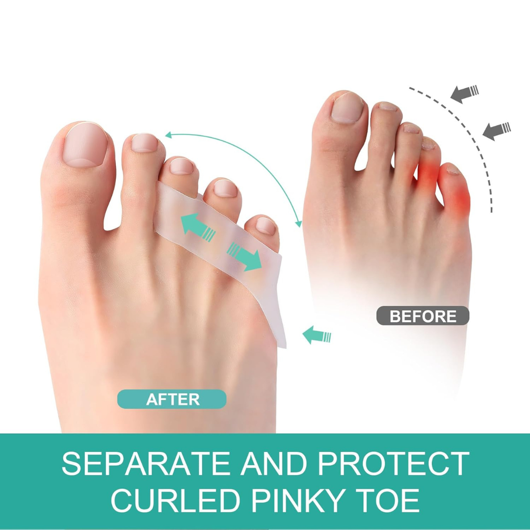 Hyggear Little Toe Tailor's Bunion Corrector