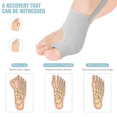 HYGGEAR BIG TOE BUNION HALLUX VALGUS CORRECTOR