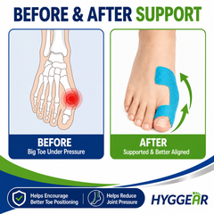 Hyggear™ Bunion Tape - 2247356287455